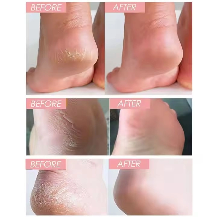 Personal Care2 Personal Care2