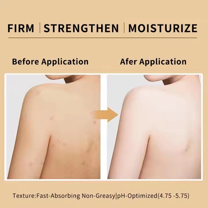 Body Lotion5 Body Lotion5