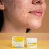 Acne Scar Spot Repair Facial Cream