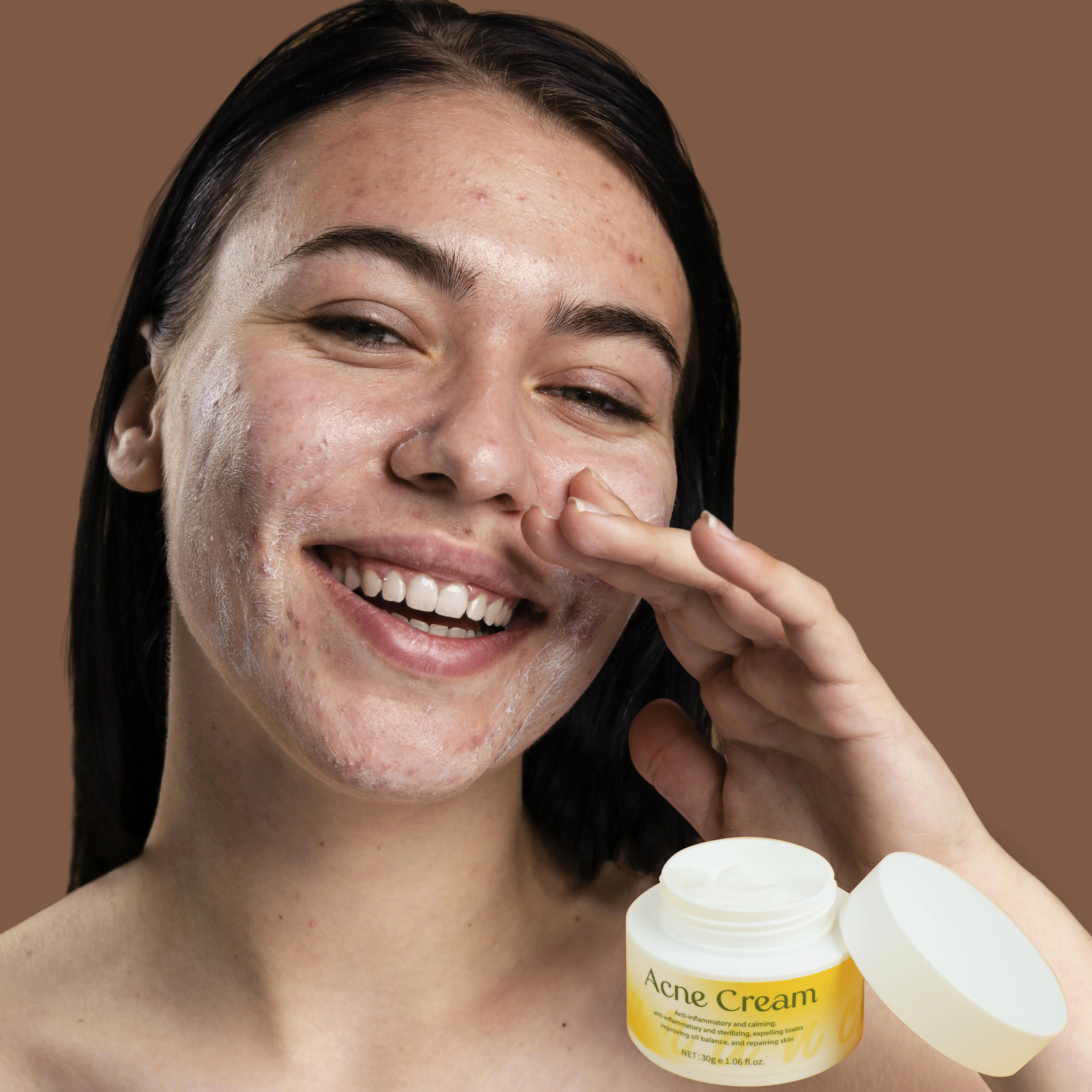 Acne Scar Spot Repair Facial Cream