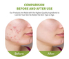 Retinol Facial Serum