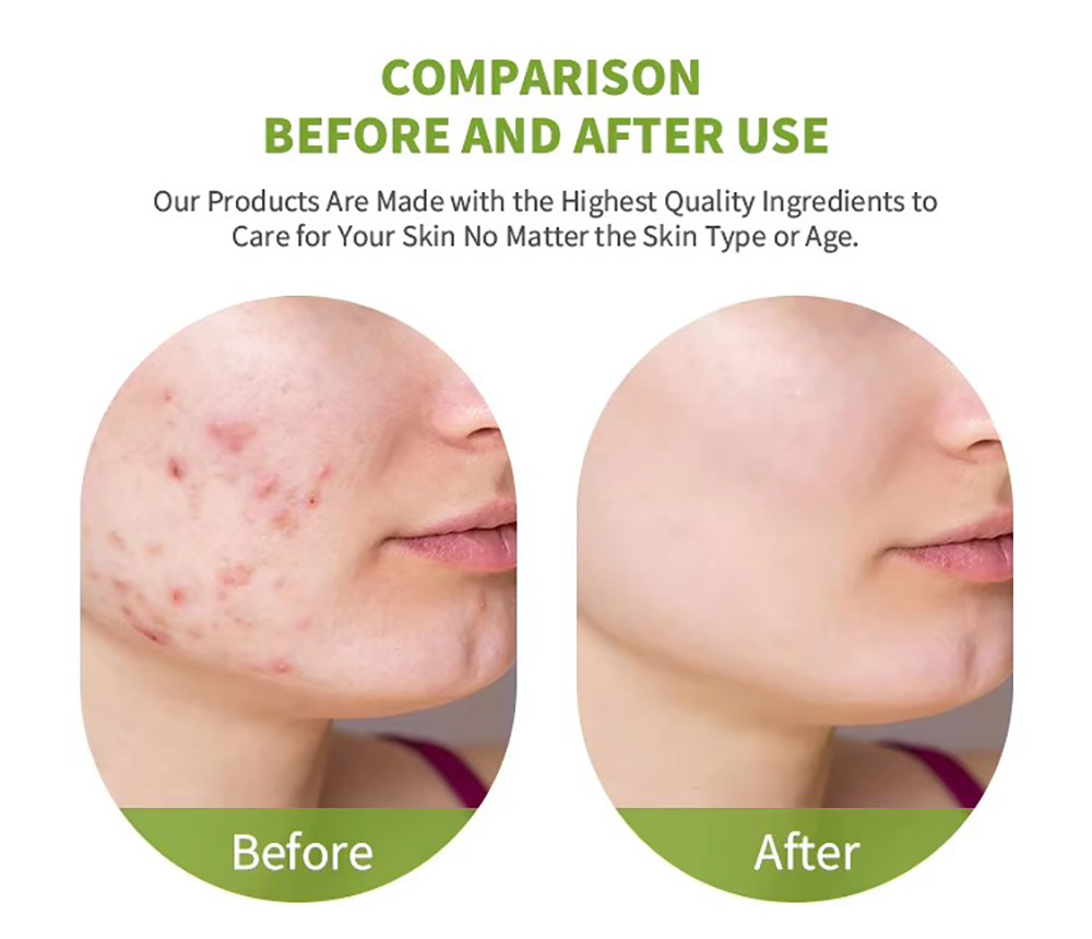 Retinol Facial Serum