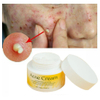 Acne Scar Spot Repair Facial Cream