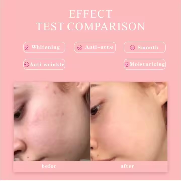 5 In 1 Multifunctional Facial Serum