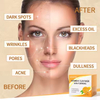 VC and Turmeric Mud Mask