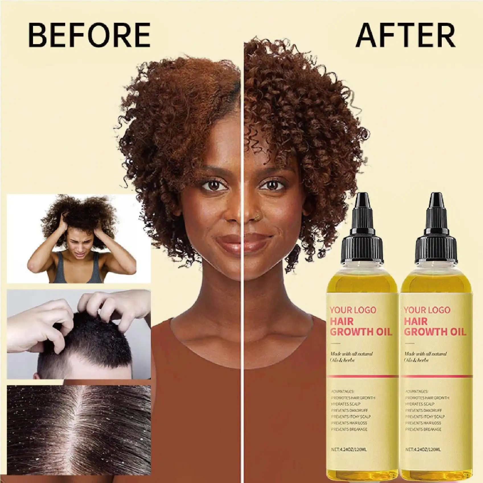 Hair treatment Growth Oil