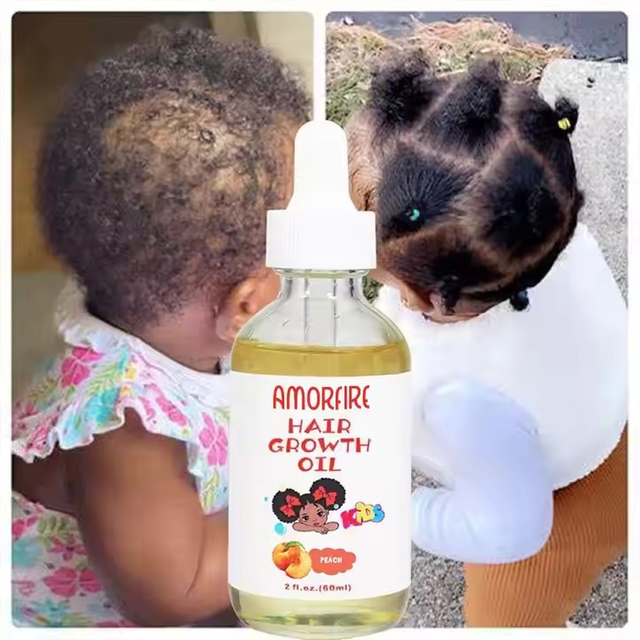 Baby Hair Growth Oil