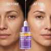DARANCA Retinol Retinal 2000 NAD+ Facial Serum Dual Vitamin A Firming Anti-Aging 30ml OEM ODM
