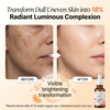 Brightening Anti Aging 18% Vitamin C Face Serum