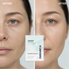 Wholesale 4 Sheet Facial PDRN Hydrogel Mask Vegan Panthenol Niacinamide Deep Hydration Firming Brightening