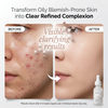 10% Niacinamide + 1% Zinc Face Serum