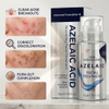 Azelaic Acid Moisturizing Facial Treatment Serum