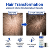 GHK-Cu Peptide Scalp Revitalizing Hair Growth Spray