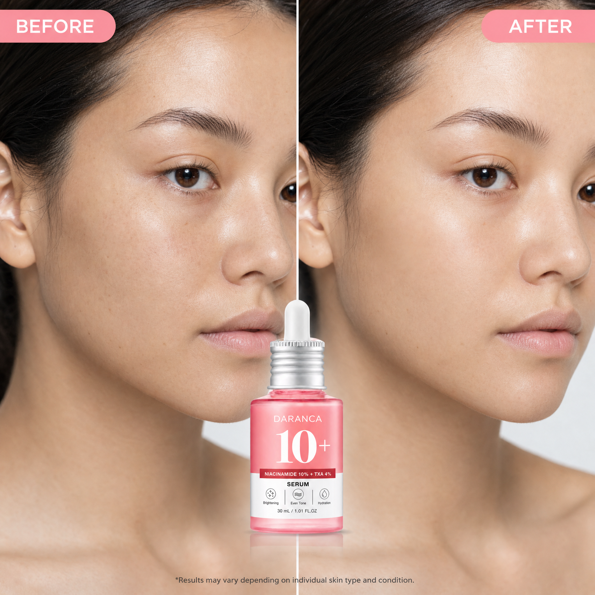 DARANCA Wholesale 10% Niacinamide 4% TXA Face Serum Brightening Even Tone Hydrating Facial Skin 30ml