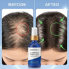 8% Complex Copper Peptide Scalp Hair Growth Serum Spray 60mL