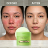 Azelaic Acid Soothing Facial Toner Pad
