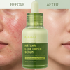 DARANCA Custom Dual-Layer Matcha Cica Face Serum Oil Control Calming Barrier Repair Essence