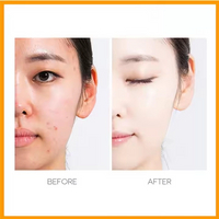 //inrorwxhjpmlli5p.ldycdn.com/cloud/prBprKjllrSRqlqipiinkq/Skin-Care10.jpg