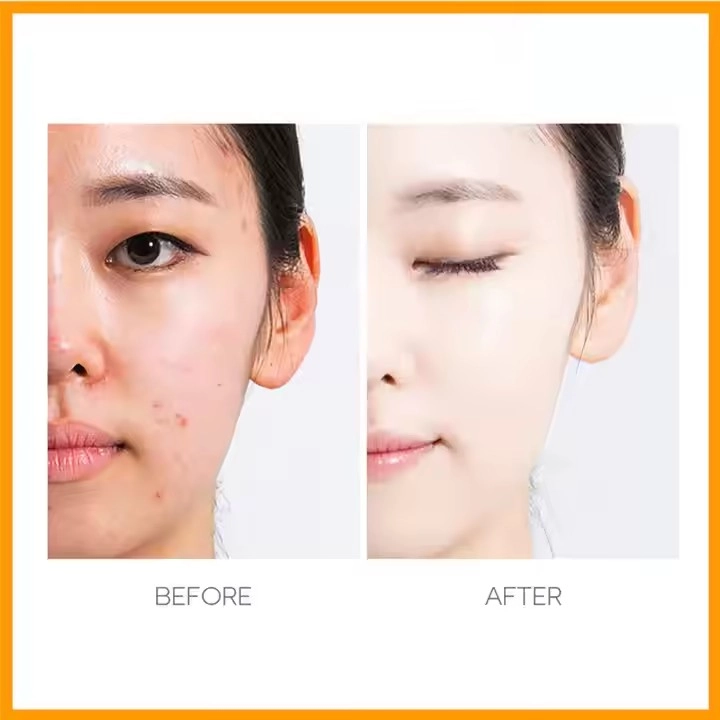 ​Best Private Label Skin Care Manufacturers — Why Guangzhou Aihuo Biotechnology Leads The Pack